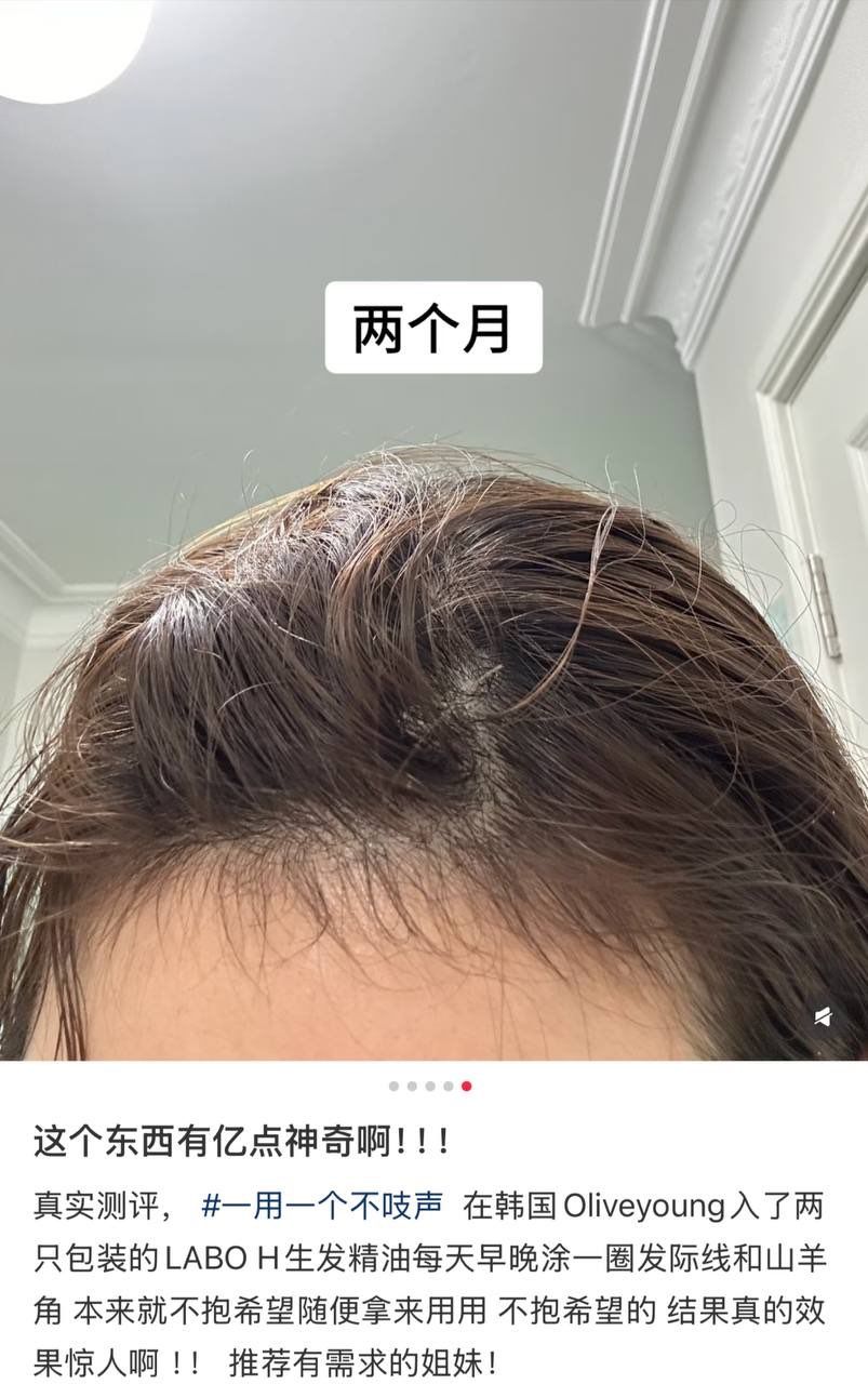 联名款三丽鸥防脱滚珠精华 5