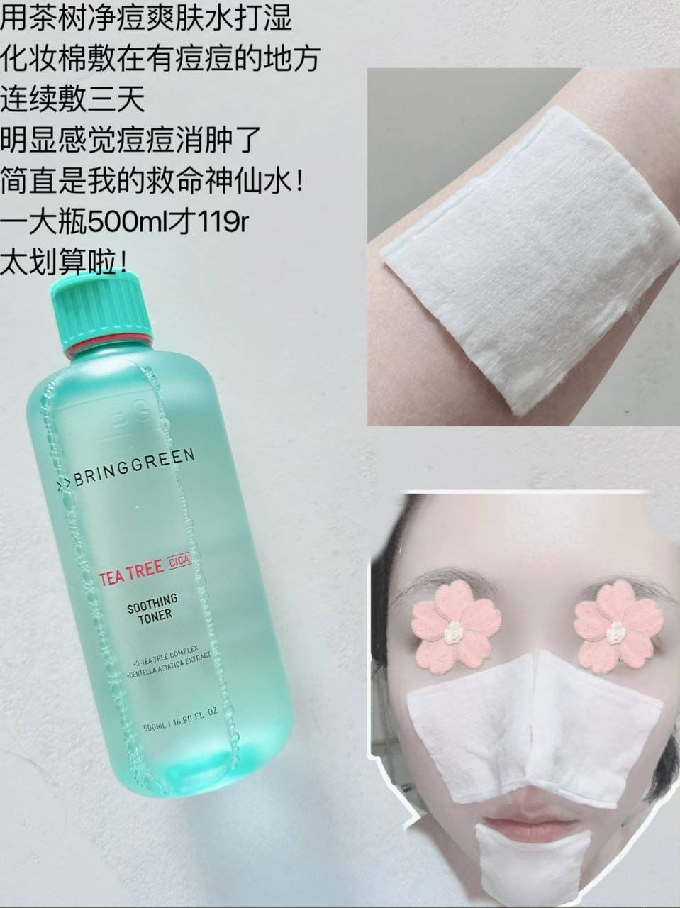 💚 Bring Green Tea Tree Cica Soothing Toner 📦 500ml / 250ml 5