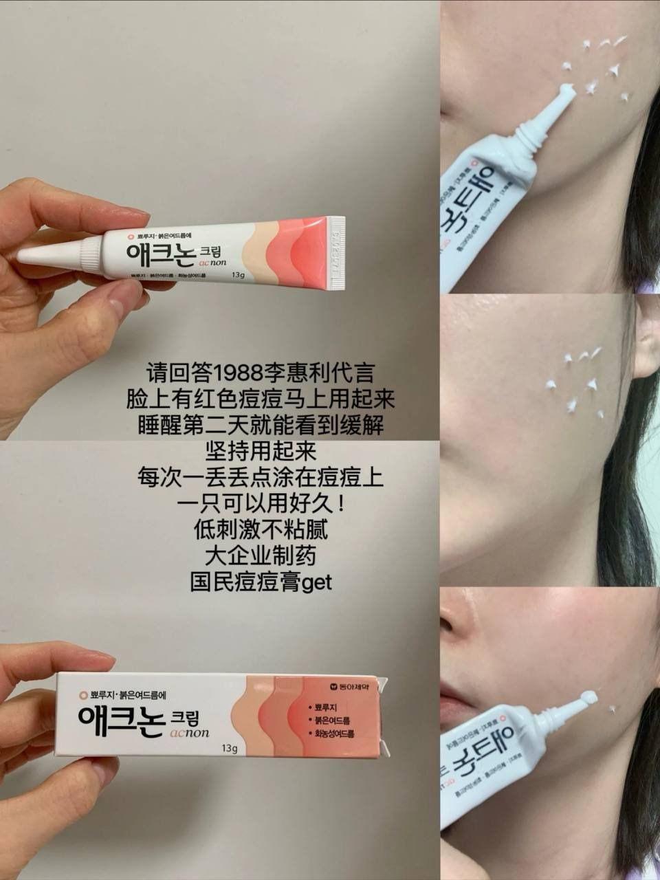 ACNON祛痘膏 13g 4