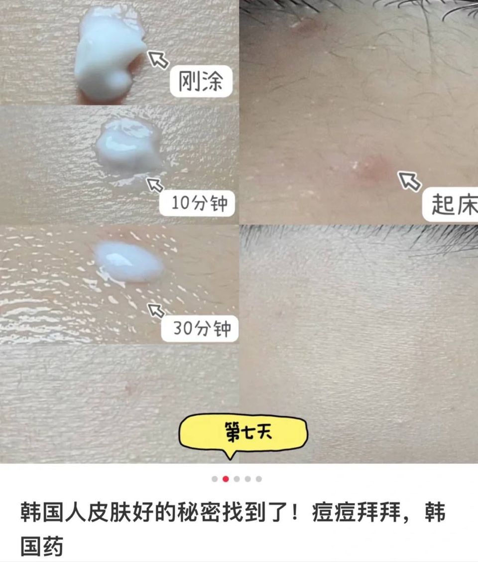 ACNON祛痘膏 13g 6